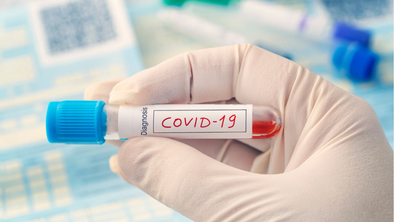 В Москве уже более 160 тыс. зараженных COVID-19, где и сколько заболевших коронавирусом в России на 25 мая 