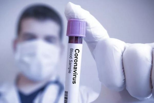 В России ежедневно фиксируют более 10 тыс новых случаев коронавируса, статистика на 11.05.2020 год