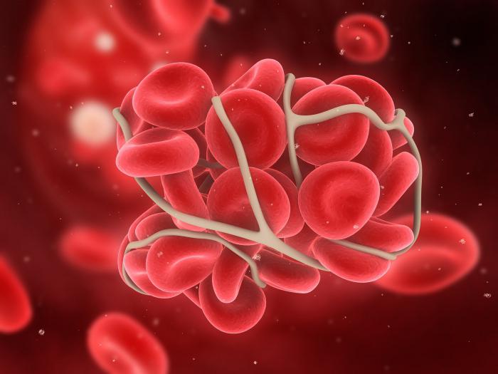 Коронавирус и свертываемость крови: какая зависимость между ними установлена врачами